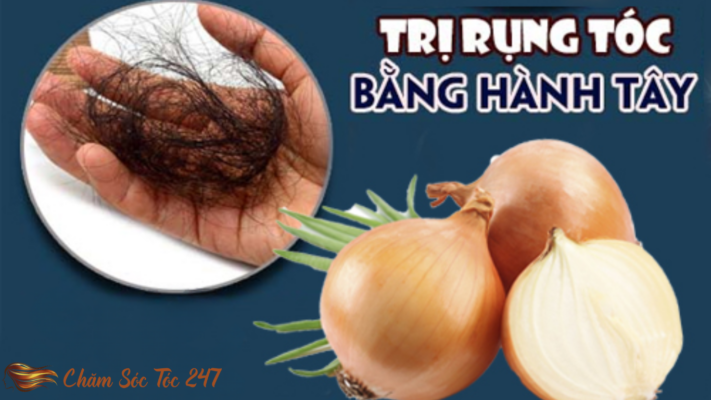 Cách Trị Rụng Tóc Bằng Hành Tây – Hiệu Quả Bất Ngờ