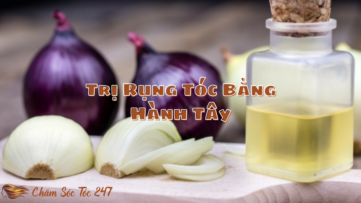 cách trị rụng tóc bằng hành tây